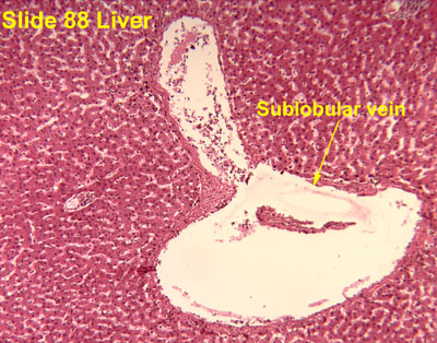 Hepatic Portal Vein Histology 